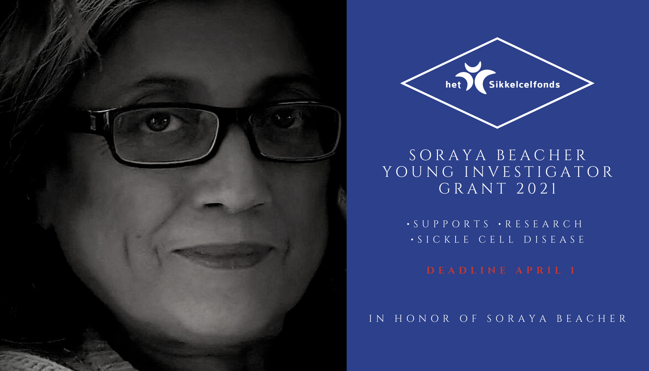 Soroya Beacher Young Investigator Grant 2021