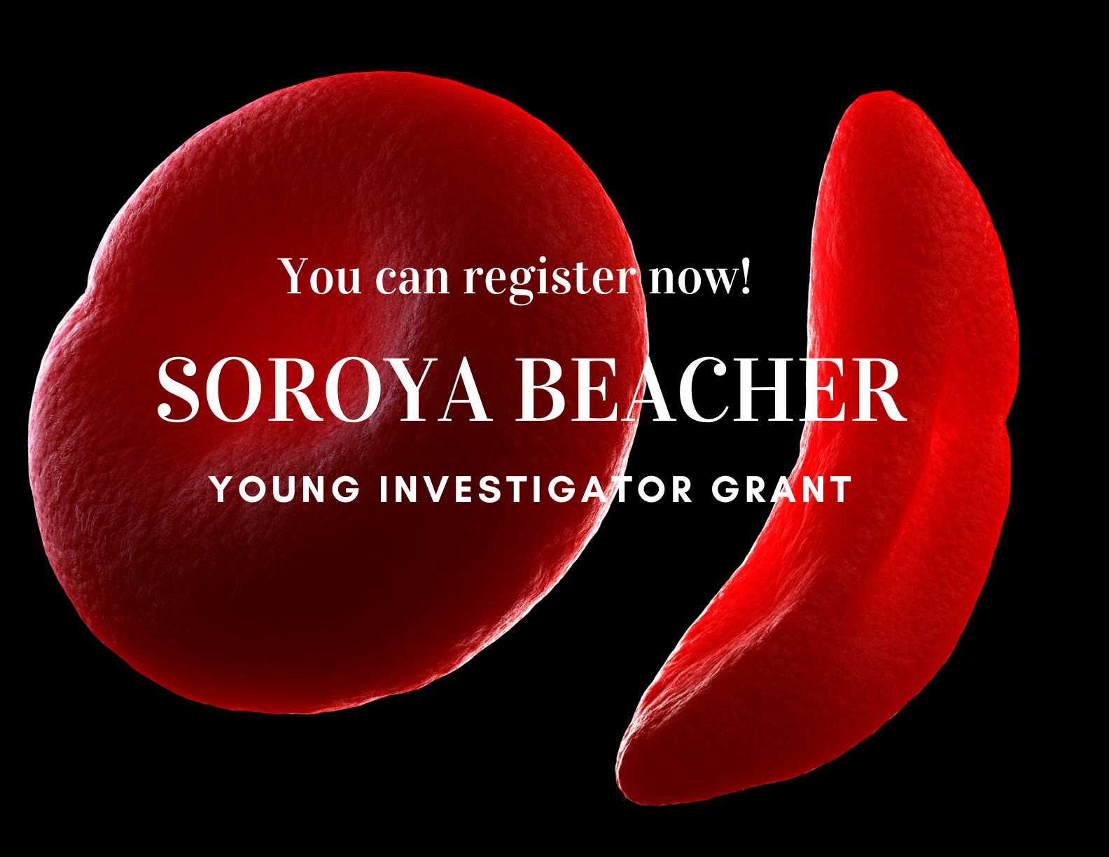 Soroya Beacher Young Investigator Grant